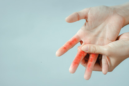 Arthritis and Joint Pain management